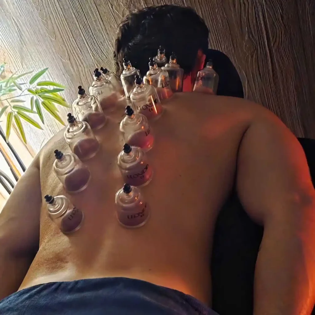 Séance de thérapie par ventouses sur le dos d'un homme pour soulager les tensions musculaires à Le Mans