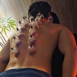 Séance de thérapie par ventouses sur le dos d'un homme pour soulager les tensions musculaires à Le Mans